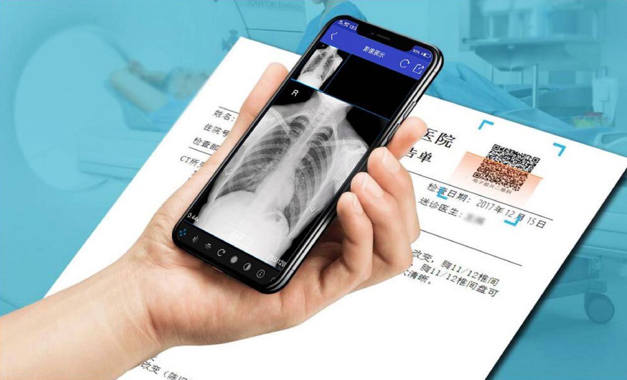 云膠片是什么？